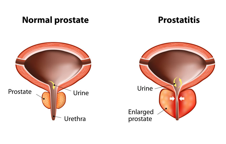 prostate support