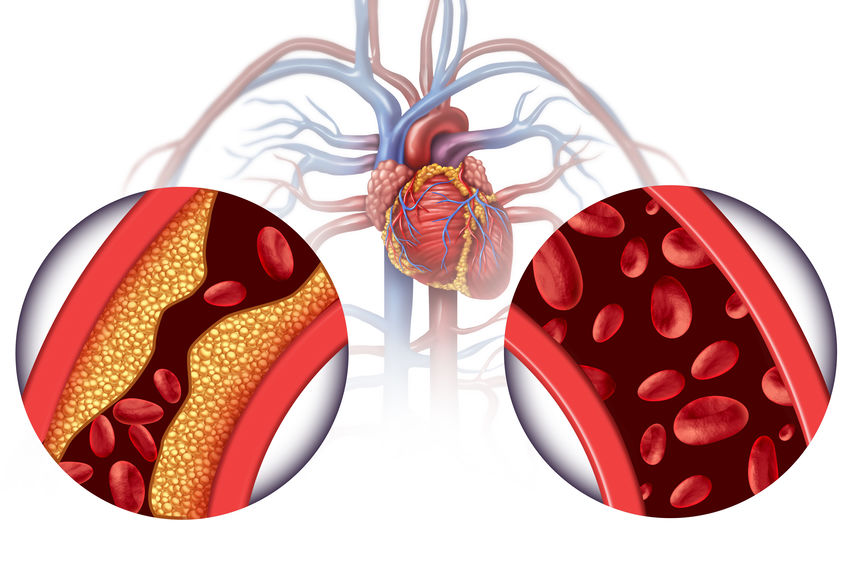 Benefits of the ketogenic diet include improved heart health.