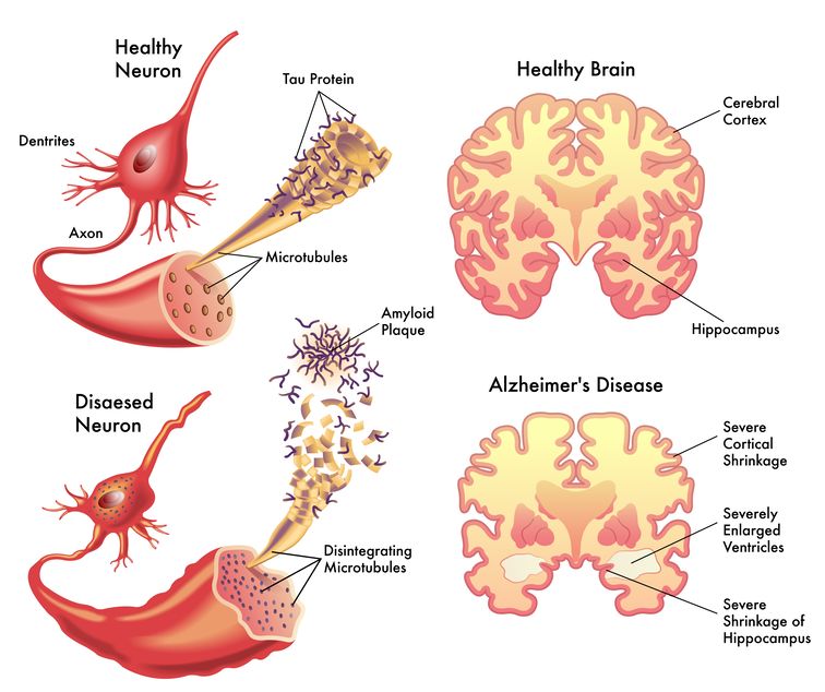 Benefits of the ketogenic diet include improved cognitive function.