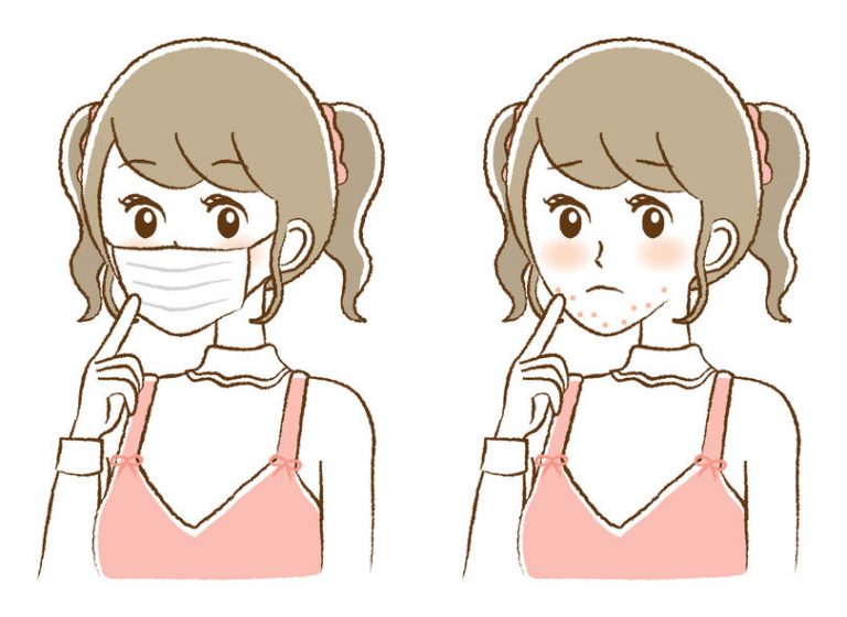 'Maskne' Tips To Effectively Deal With Mask Acne