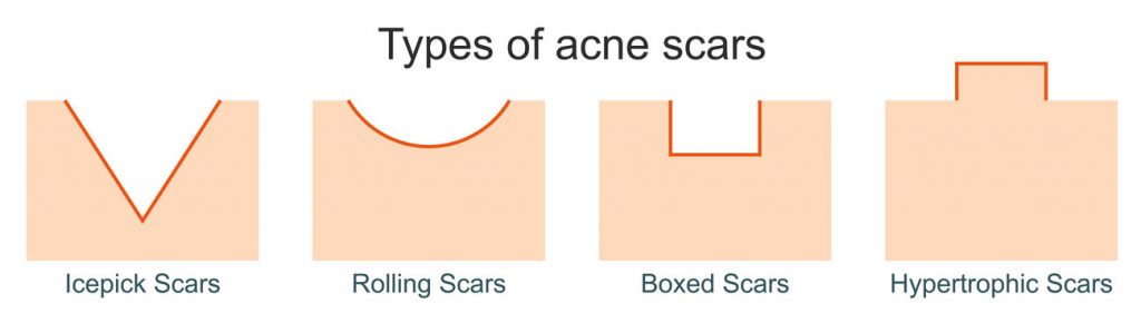 Approved Science® ScarRid™ Review: An Effective Solution for Scarring