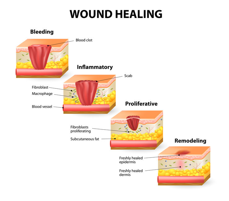 Approved Science® ScarRid™ Review: An Effective Solution For Scars.