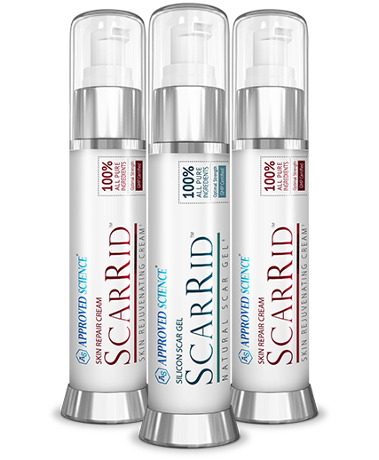 Approved Science®  ScarRid™ Review - The Fast-Acting Solution For Healing And Fading Scars