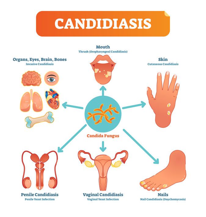 Candida can cause nail fungal infections.