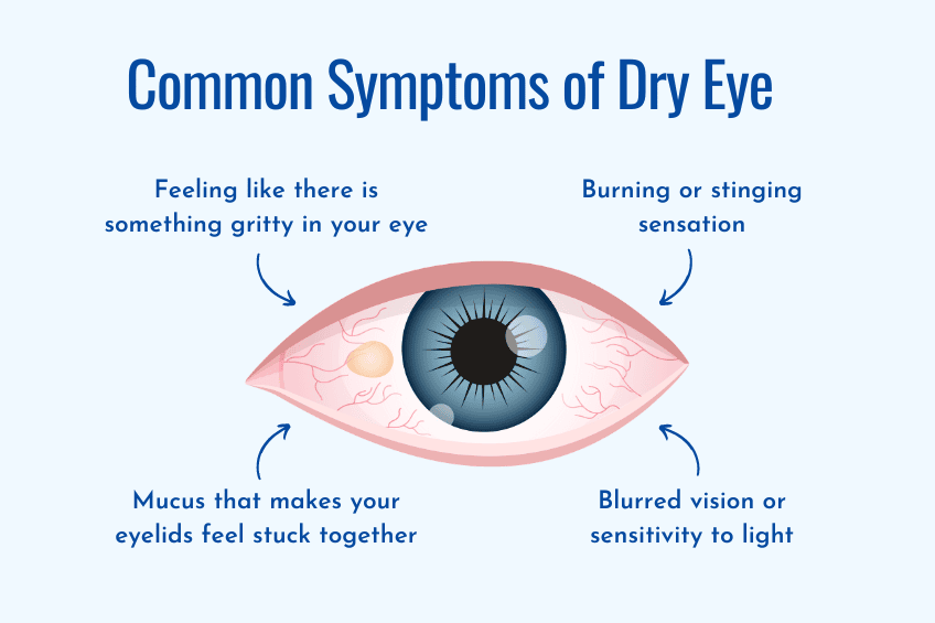 Common symptoms of dry eye