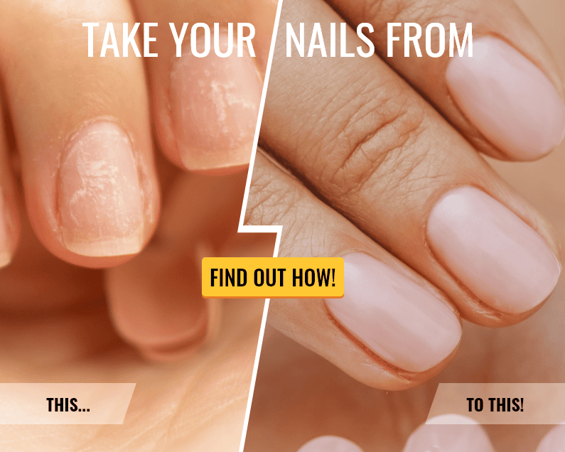 Before and after of unhealthy to healthy nails. 