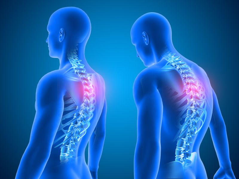 Two blue, semi-transparent human figures showing highlighted pain or inflammation in the upper back and spine, with their spinal columns clearly visible.